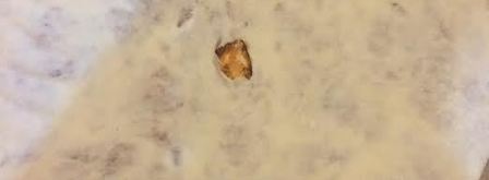 лобиани — лепешка с фасолью. Шаг 10