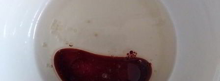 маринованные шампиньоны. Шаг 2