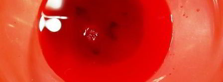 закуска из зеленого горошка и сельди. Шаг 7